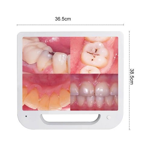 Dental Intraoral Screen Badawneh Medical Group Dental intraoral screen badawneh medical group