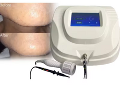 Electrolysis Hair Removal Device