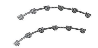 Lingual Retainers 3-3