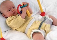 Pavlik Harness and Hip flexion and abduction orthosis